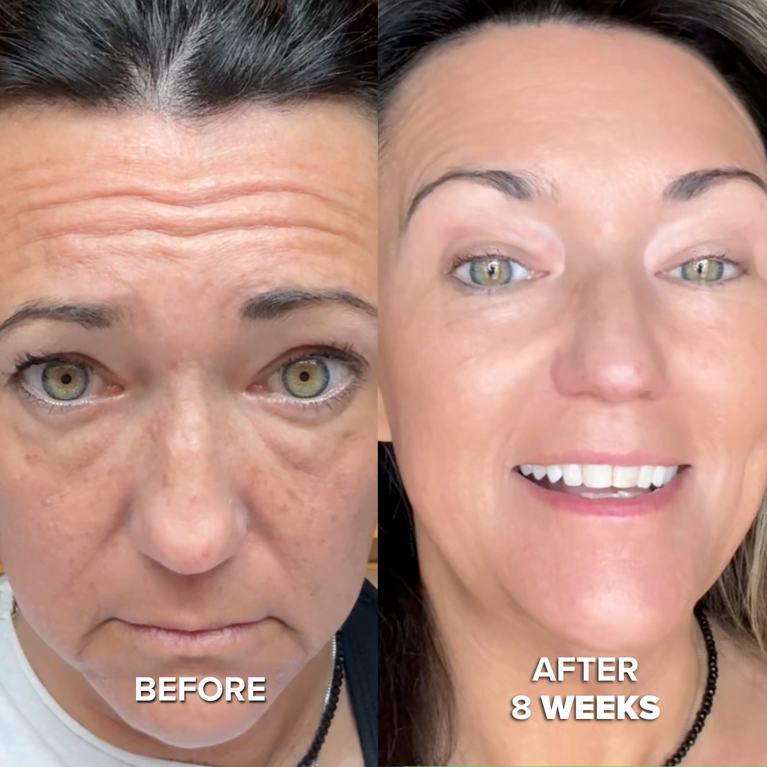 AFTER_8_WEEKS_optimized_2.png Collagen Mask - Image 4