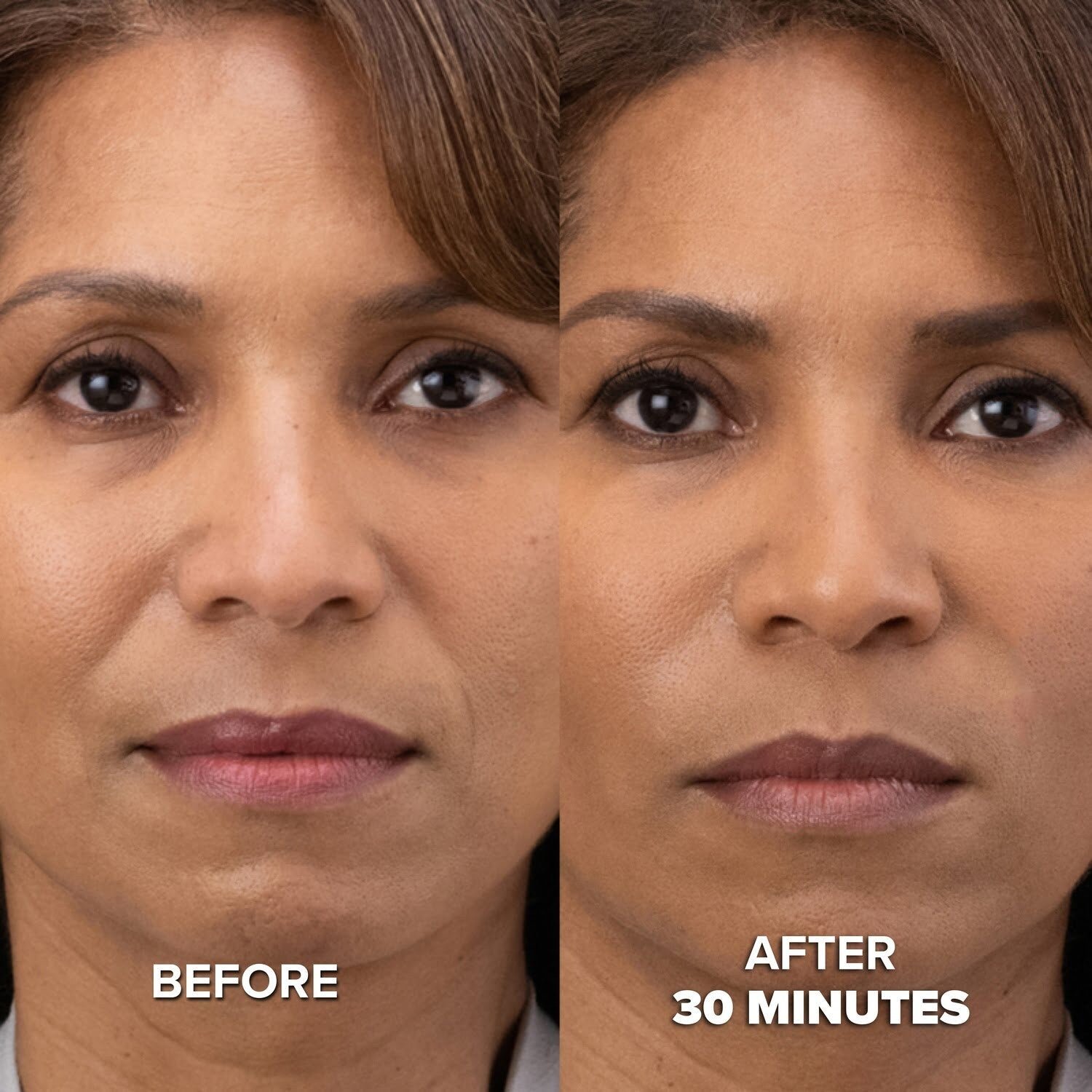 BEFOREAFTER1_optimized.jpg Collagen Mask - Image 5