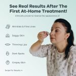 The Microneedling Infusion System™ - Image 5
