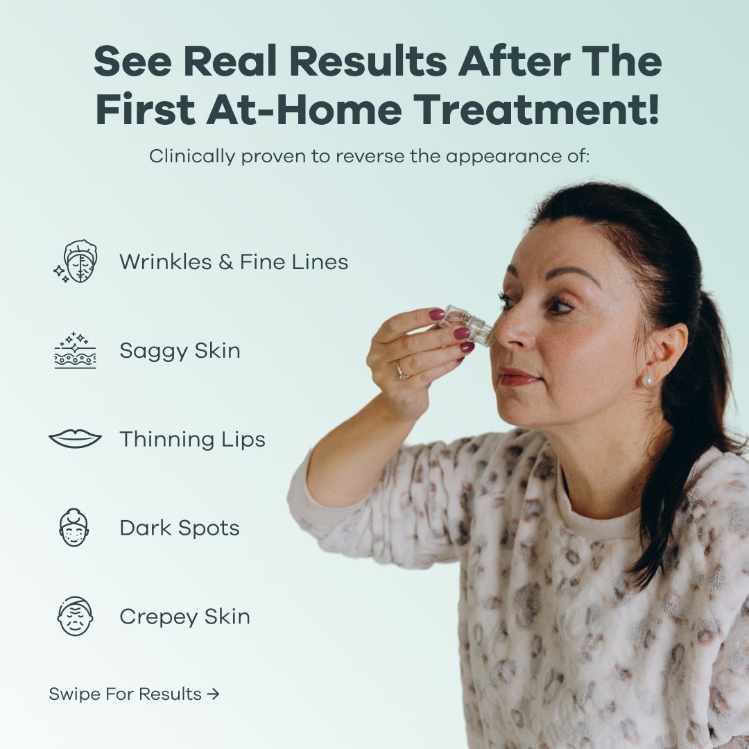 the-microneedling-infusion-system-131591.jpg The Microneedling Infusion System™ - Image 5
