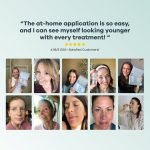 The Microneedling Infusion System™ - Image 11